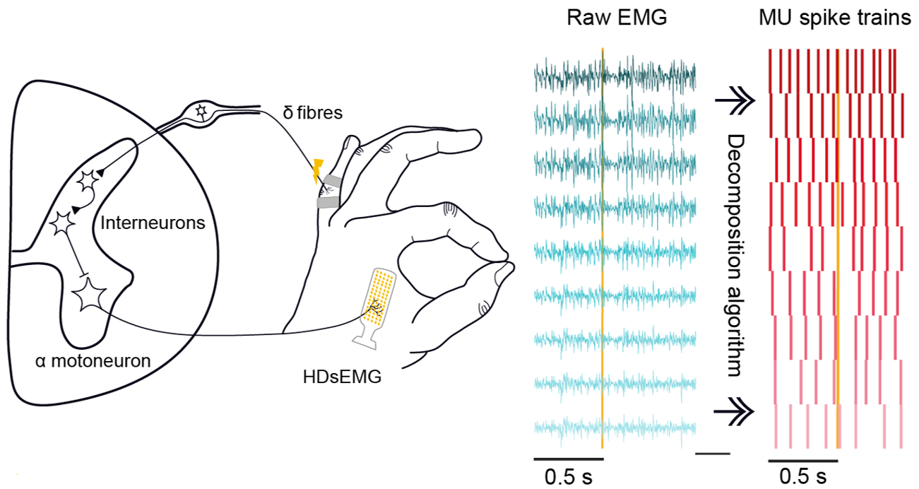 Schematic of HDsEMG recording from a hand muscle during stimulation of digital nerves, with raw EMG decomposed into motor unit spike trains.