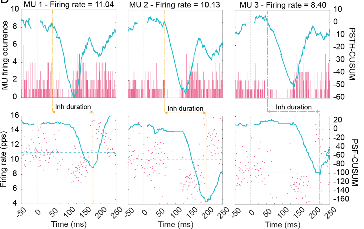 Peristimulus time histograms and peristimulus frequencygrams with CUSUM traces for three motor units, showing inhibition duration.