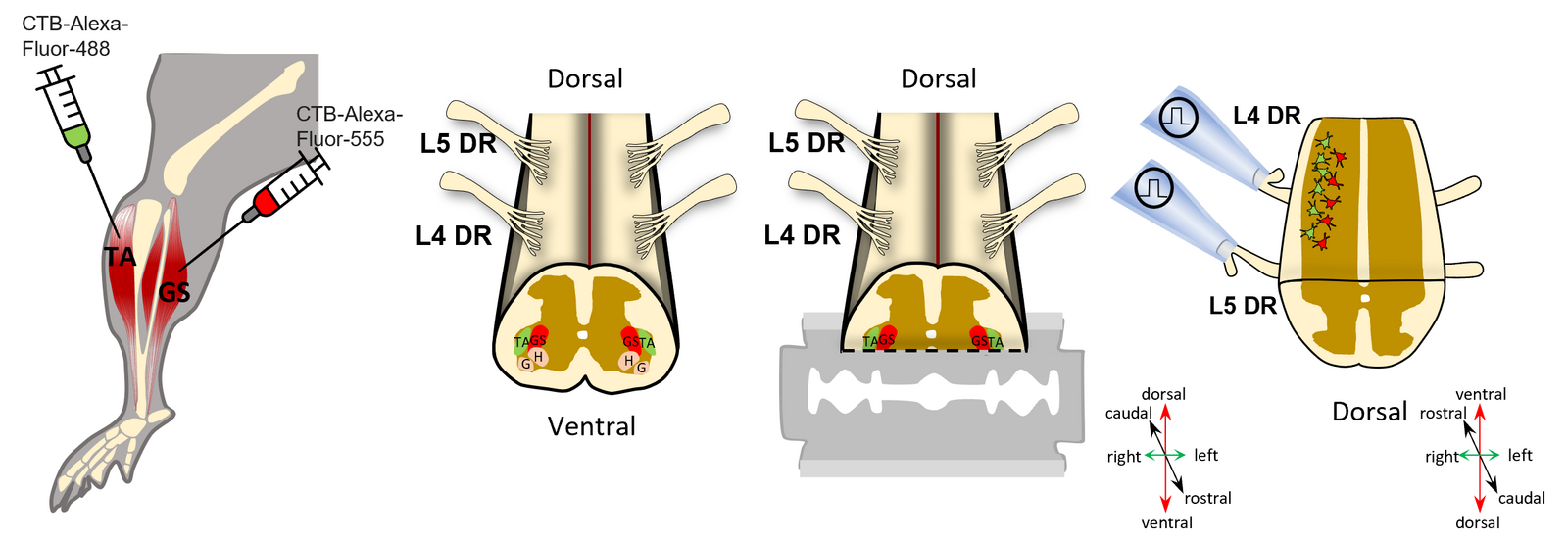 Schematic of retrograde labelling of tibialis anterior and gastrocnemius motoneurons and preparation of a longitudinal spinal cord slice.