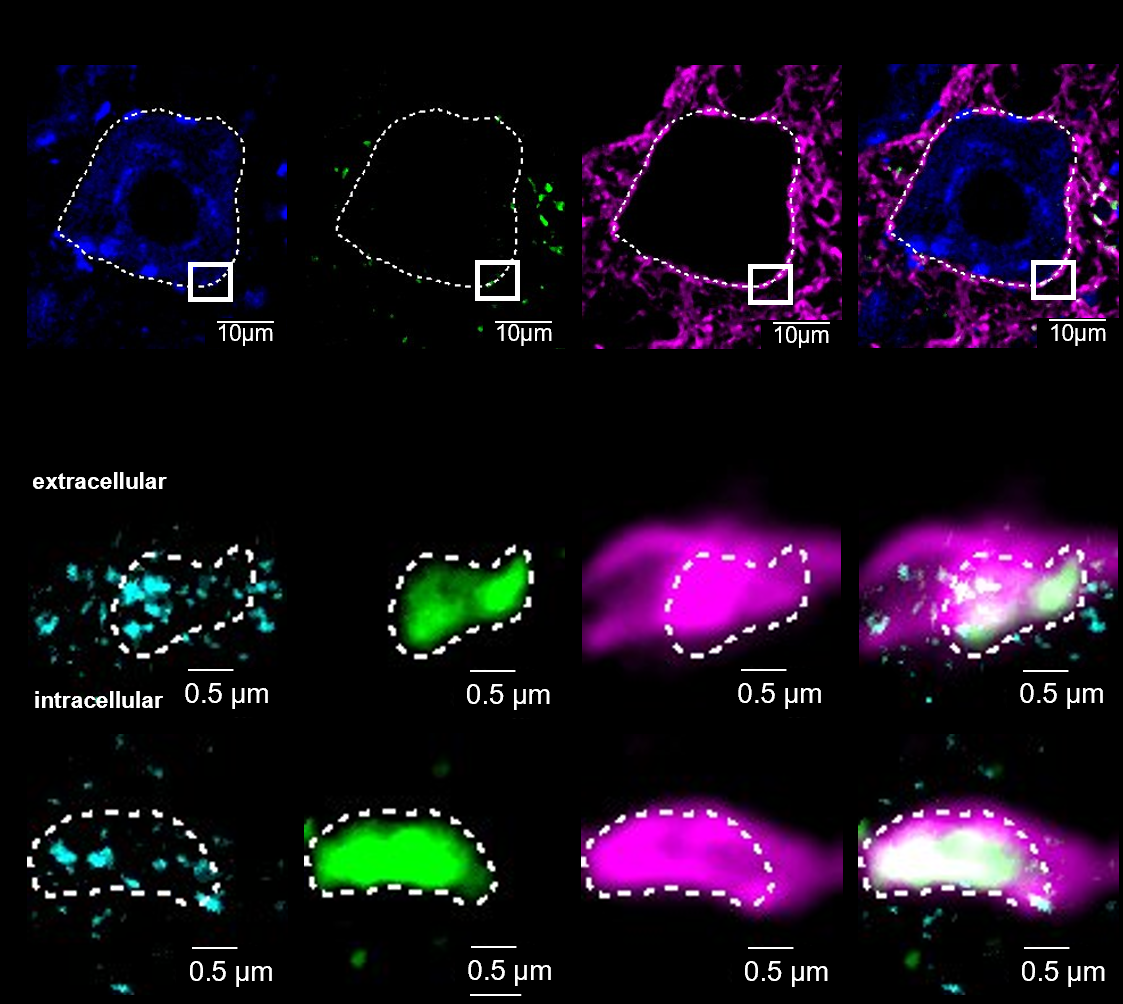 Confocal images of a motoneuron with high-magnification views of synaptic contacts.